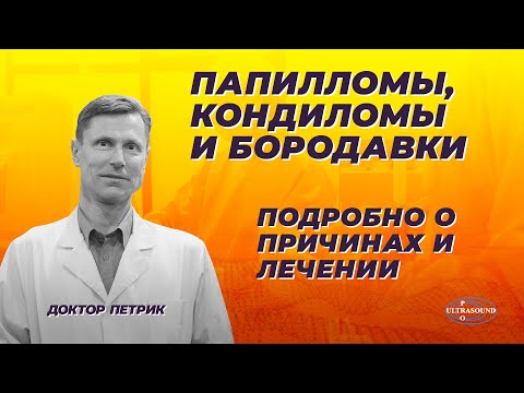 Видео: Папилломы, кондиломы и бородавки. Внутренние причины и лечение.