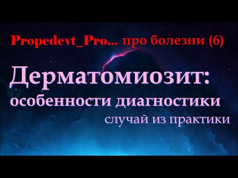 Видео: Идиопатический дерматомиозит. Случай из практики.