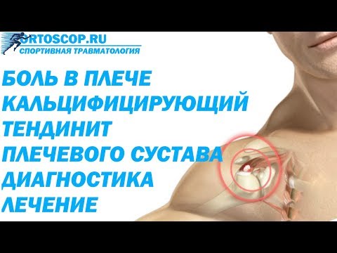 Видео: КАЛЬЦИФИЦИРУЮЩИЙ ТЕНДИНИТ ПЛЕЧЕВОГО СУСТАВА