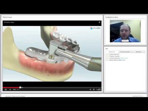 Видео: 2014 04 15 Концепция R2Gate one day implant  0001