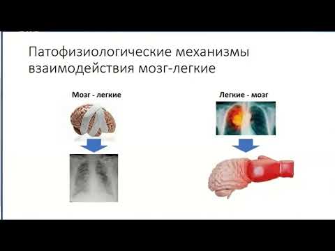 Видео: Мозг -  легкие - ОДН Полупан А.А. 2022