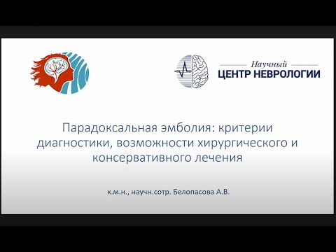 Видео: Парадоксальная эмболия: критерии диагностики, возможности хирургического и консервативного лечения