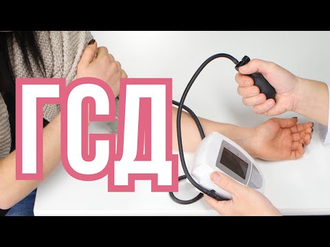 Видео: ГСД Беременных Тактика Лечения Беременность и Роды