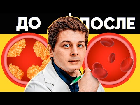 Видео: Что будет с вашим организмом если пить статины каждый день