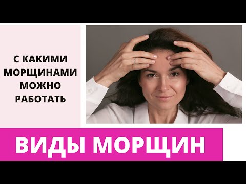 Видео: ВИДЫ МОРЩИН. Ирэн Влади