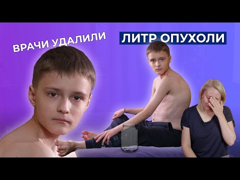 Видео: CLOVES-СИНДРОМ | История Ильи Бусарова