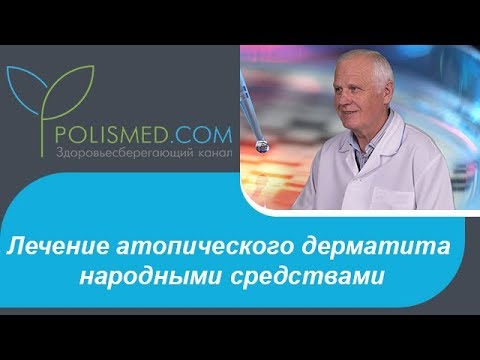 Видео: Лечение атопического дерматита народными средствами: ванны, травы, соль, сода, деготь, компрессы