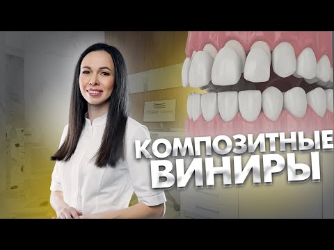 Видео: Композитные виниры. ВИНИРЫ. Стоматология. Всё про композитные виниры.