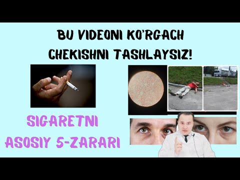 Видео: СИГАРЕТ ЧЕКШНИ ТАШЛАШ / ОҚИБАТЛАРИ ТЕЗ СИЗГА КЕЛАДИГАН 5-АСОСИЙ ЗАРАРИ / ХАММА КЎРСИН БОЛАЛАР КЎРСИН