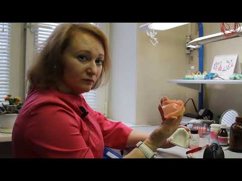 Видео: Изготовление полного съемного протеза с мягкой эластичной прокладкой
