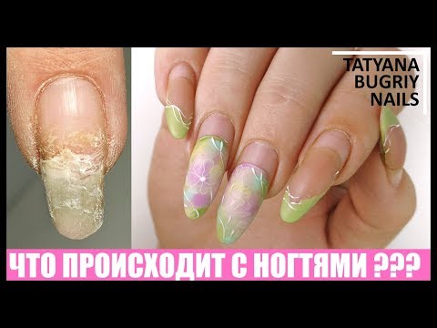 Видео: Почему НЕЛЬЗЯ перенашивать Покрытие!!! Что с Ногтями под Гелем!!! Коррекция Акрилатиком Cosmoprofi