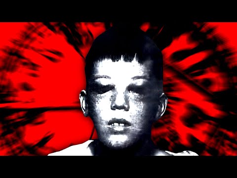 Видео: Полный ужас лоботомии