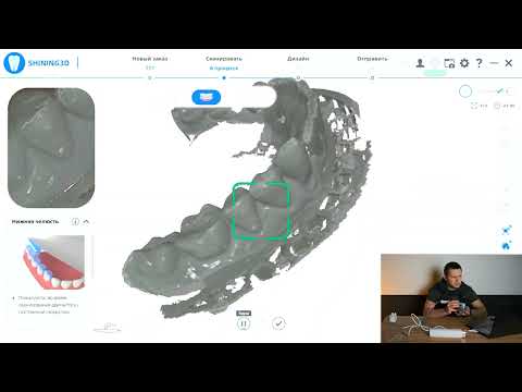 Видео: Обзор, первый запуск и работа со сканером Shining 3D Aoralscan 3