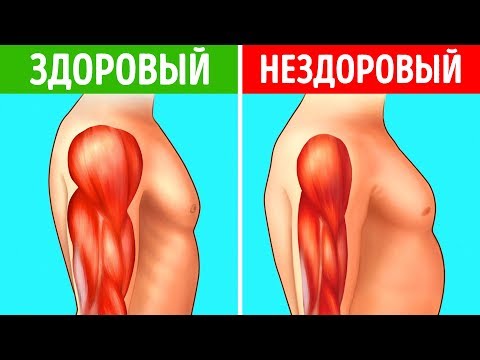 Видео: 8 Ранних Признаков Дегенерации Мышц. Не Игнорируйте их!