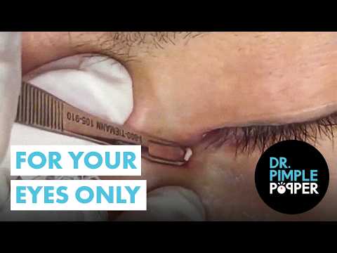 Видео: Хэллоуин: только для твоих глаз 👁️ | Подборка самых жутких выпученных глаз