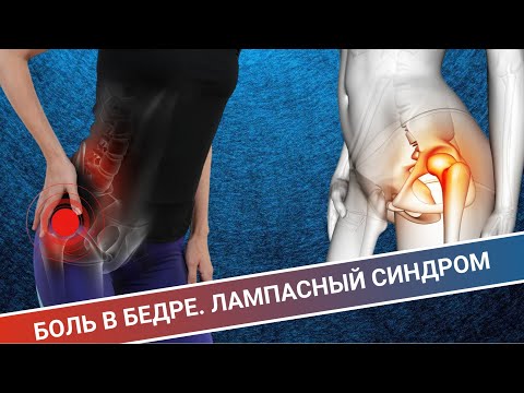 Видео: БОЛЬ В БЕДРЕ || ЛАМПАСНЫЙ СИНДРОМ