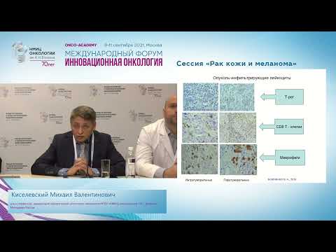 Видео: Иммунитет и меланома: почему спонтанная регрессия первичной опухоли не означает излечения?