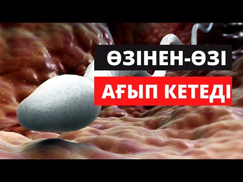 Видео: Мүшедегі сұйықтық неге өзінен-өзі ағып кетеді?