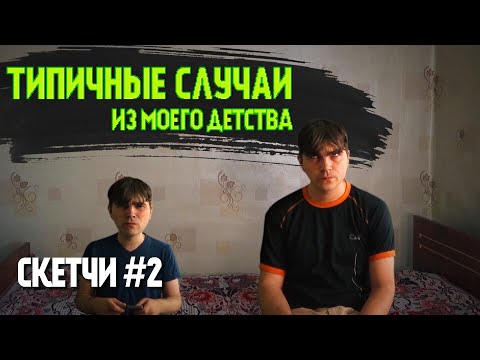 Видео: ТИПИЧНЫЕ СЛУЧАИ ИЗ МОЕГО ДЕТСТВА СКЕТЧИ ВЫПУСК 2
