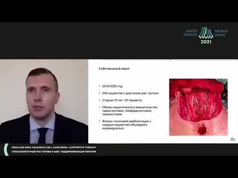Видео: Особенности хирургического лечения  у пожилых пациентов с опухолями головы и шеи (Гузь А.О.)