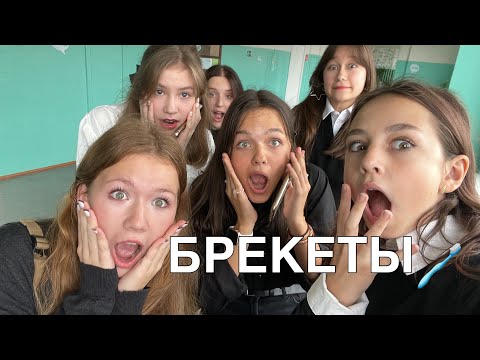 Видео: ВЛОГ🫣УСТАНОВКА БРЕКЕТОВ🦷😬🪥