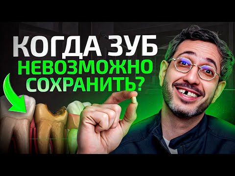 Видео: Какие должны быть показания для удаления зуба? УДАЛЕНИЕ ЗУБОВ