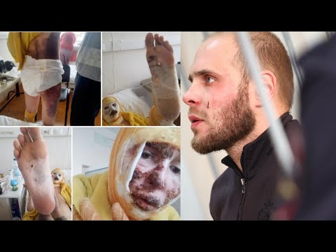 Видео: ПРИБИЛ К ПОЛУ и ЗАЖИВО ПОДЖОГ. ШОКИРУЮЩАЯ ИСТОРИЯ СВАРЩИКА-НЕЛЮДЯ