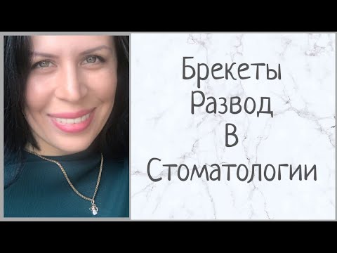 Видео: Брекеты, мой опыт | Развод в стоматологии | олесягес