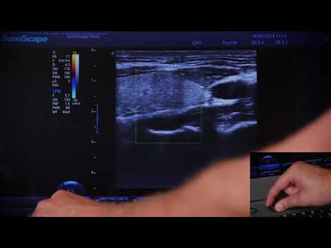 Видео: S2N 04 Цветной допплер