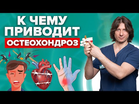 Видео: Что такое остеохондроз позвоночника? Причины остеохондроза и его проявления //16+