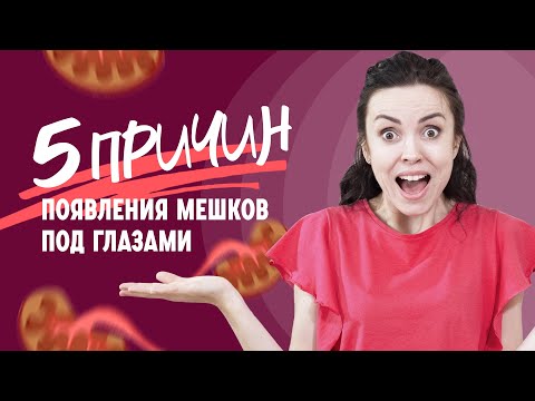 Видео: Мешки и отёки под глазами | 5 причин появления (16+)
