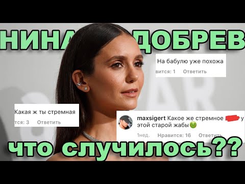 Видео: НИНУ ДОБРЕВ ХЕЙТЯТ ЗА ВНЕШНОСТЬ - ПРИЧИНЫ, Неудачная пластика или обыкновенное старение?