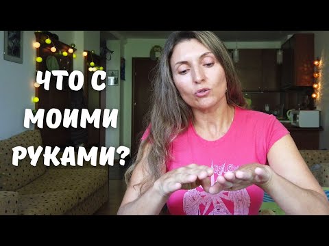 Видео: Пальцы не сгибались и слезали ногти...Неожиданный диагноз!