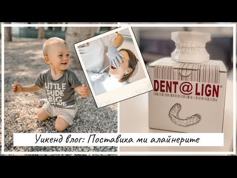 Видео: Уикенд влог: Поставиха ми алайнери и първи впечатления