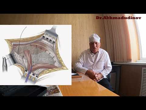 Видео: Грыжи. Грыжесечение. часть 2. Профессор Ахмадудинов М.Г.