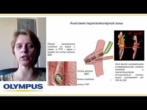 Видео: Метод ЭРХПГ. Е. Н. Солодинина