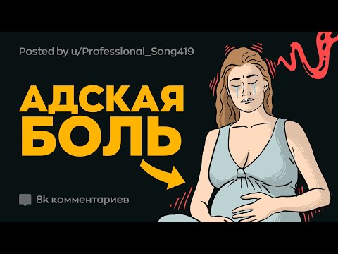 Видео: Жуткие Факты о Беременности, Родах и Послеродовом Периоде