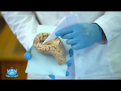 Видео: Строение островка головного мозга