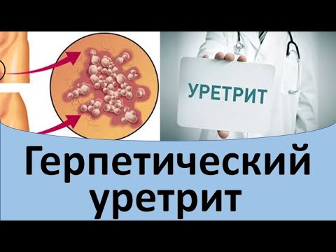 Видео: Герпетический уретрит