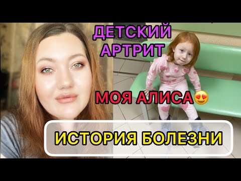 Видео: Детский артрит || наша история болезни || как живем и как лечимся.