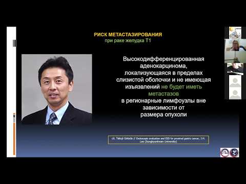 Видео: 4. Перфильев, Пирогов. Ранний рак желудка с онкологических позиций: Не все то золото, что блестит