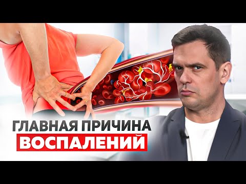 Видео: Одно действие ОТ ВСЕХ воспалений в теле. Как снизить воспаление и уменьшить боль БЕЗ ЛЕКАРСТВ!