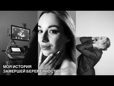 Видео: МОЯ ИСТОРИЯ ЗАМЕРШЕЙ БЕРЕМЕННОСТИ