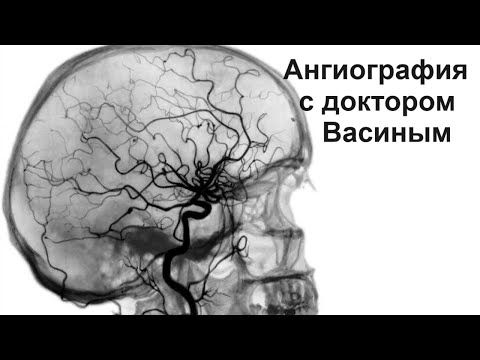 Видео: Ангиография с доктором Васиным