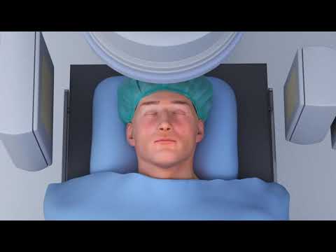 Видео: Тромбоаспирация с Penumbra