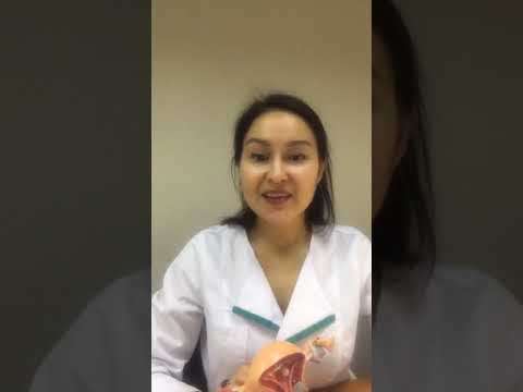 Видео: Лейомиома. Откуда берется? Стоит ли переживать?