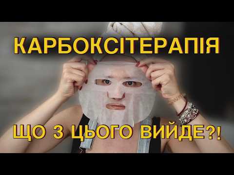 Видео: ДОМАШНІ Б'ЮТІ-ПРОЦЕДУРИ ✨ Тестую КАРБОКСІТЕРАПІЮ вдома 😳 ЦЕ РЕАЛЬНО ПРАЦЮЄ?
