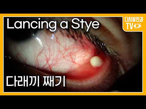 Видео: Вскрытие ячменя II