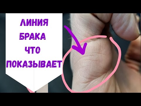 Видео: ЛИНИЯ БРАКА РАССКАЖЕТ О ВАС