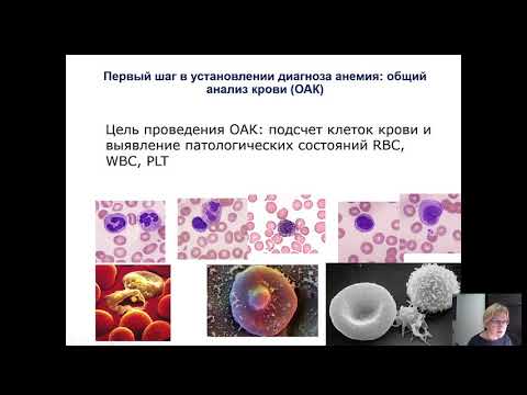 Видео: Анемия, общие сведения, дефицитные анемии